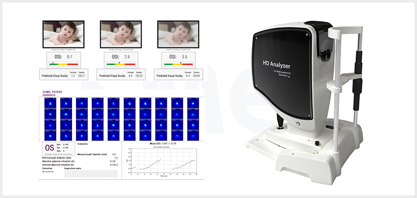 HD Analyzer 오카스(빛산란 시광학 특성 분석검사)장비 이미지