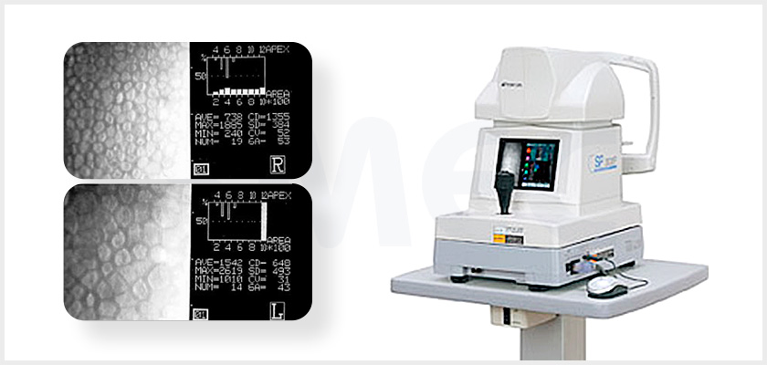 각막내피세포 검사기  장비 실제 이미지
