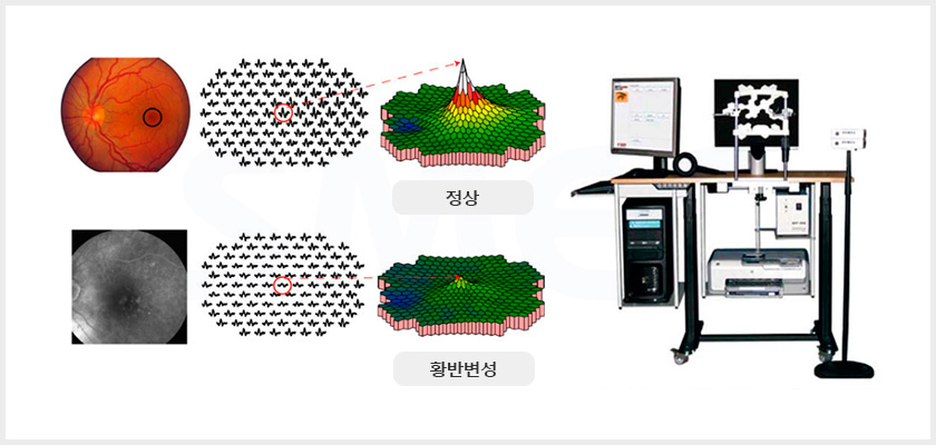 망막 및 시신경 전위 검사기 장비 실제 이미지