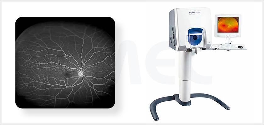 광범위 안저 및 망막혈관 촬영기 장비 실제 이미지