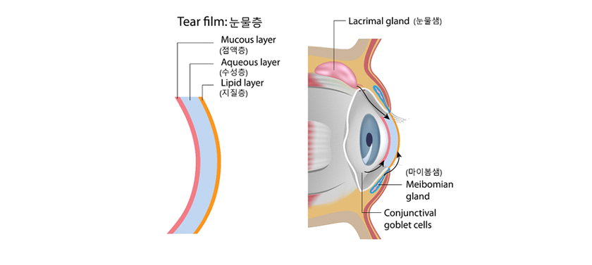 눈물층 사진