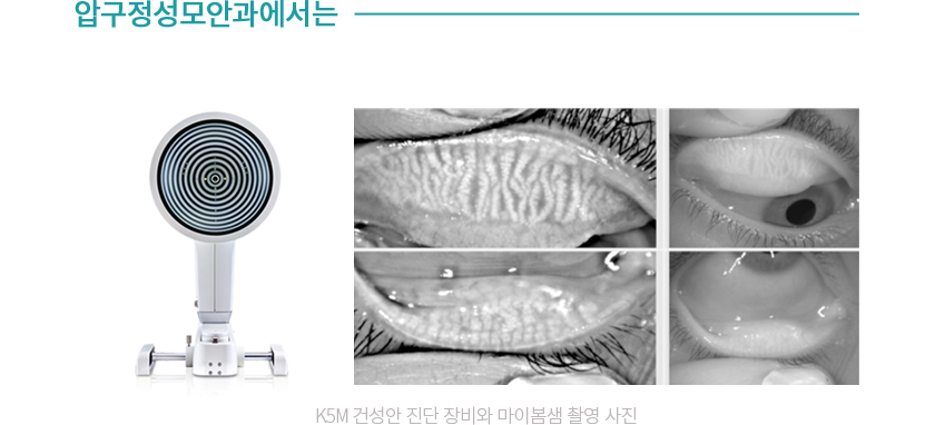 마이봄생 촬영 사진