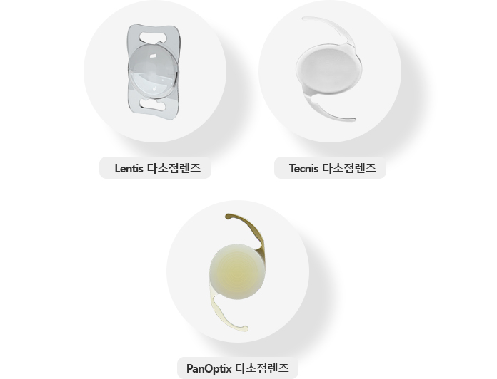 다초점 인공수정체 (프리미엄 렌즈) 종류(Lentis 다초점렌즈, Tecnis 다초점렌즈,Lisa 다초점렌즈,  Restor 다초점렌즈) 이미지 입니다.