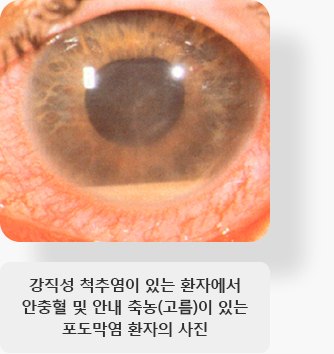 광각형광안저촬영검사 이미지 입니다.